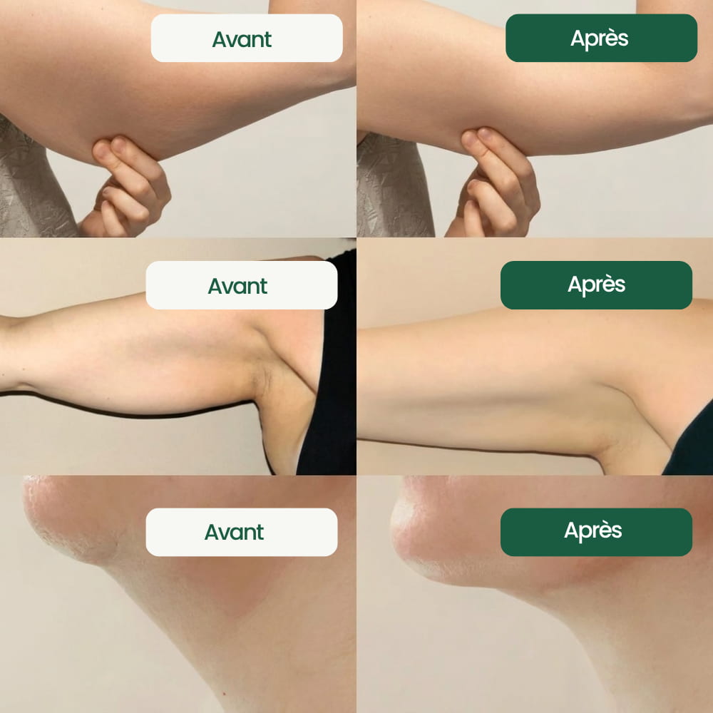 Flova - Drainant lymphatique