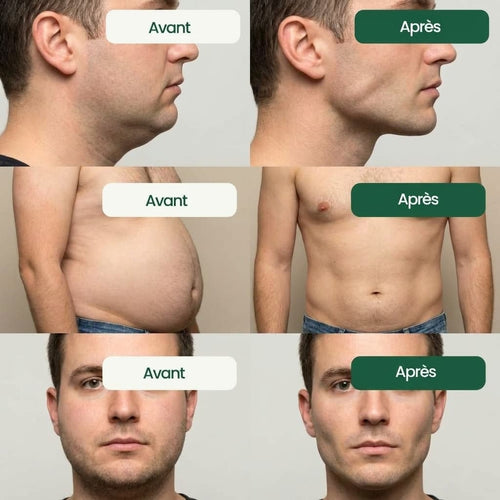 Flova Drainant lymphatique